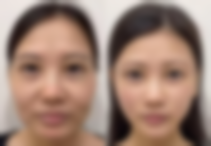 医院选择和注意事项