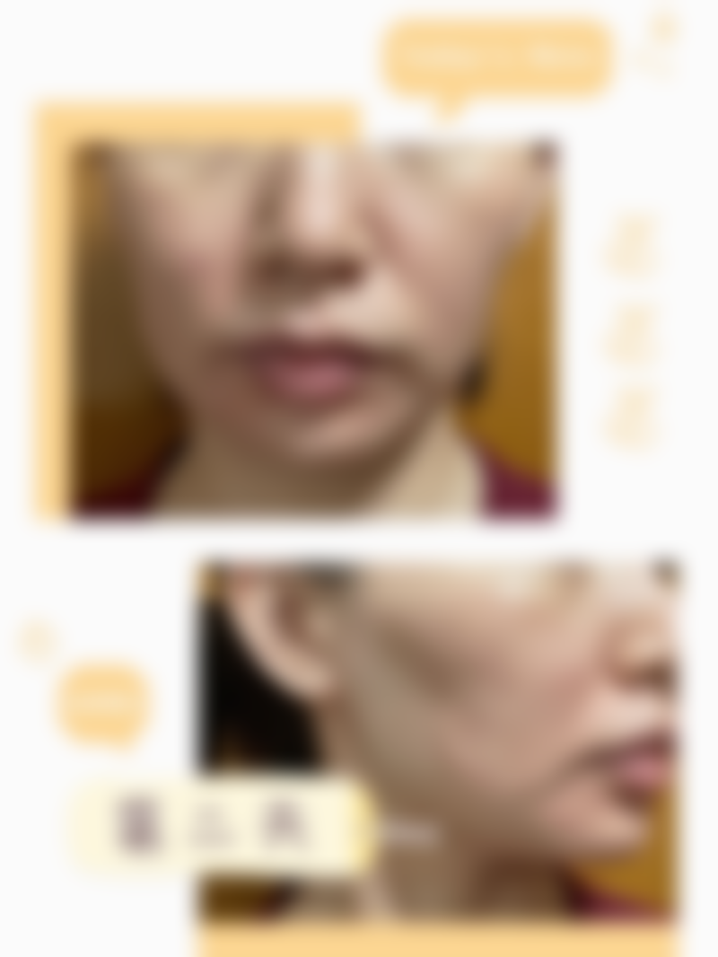 体验半岛超声炮项目后成效如何?