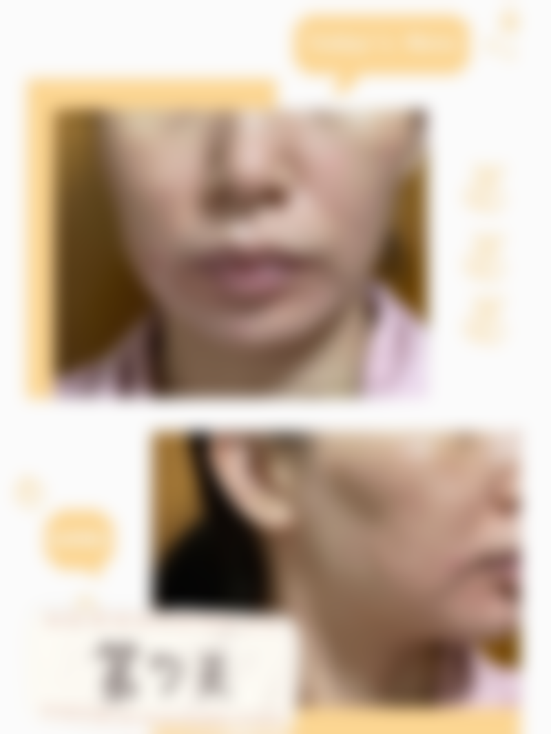 对广东韩妃医疗美容医院半岛超声炮项目的个人感受如何?