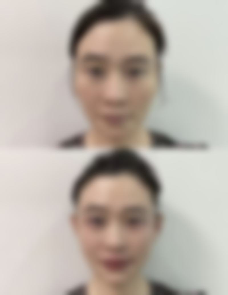 成都星范医疗美容医院收费标准参考