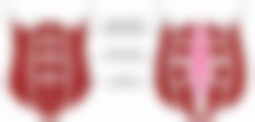 阴唇大是否需要做手术缩小