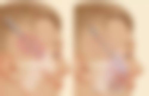 唇部整形常见项目及价格范围是怎样的呀