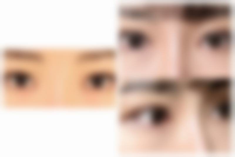 打美白针多久能喝酒？恢复情况不同喝酒时间有别，还有这些注意事项要知