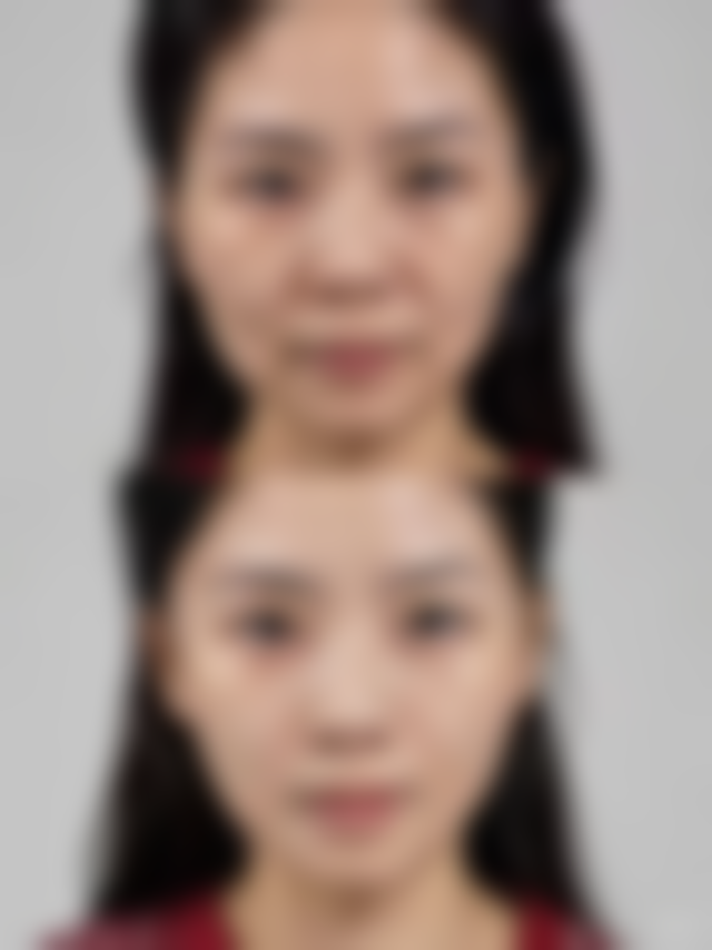 上海瑞妮丝医疗美容门诊部收费标准参考