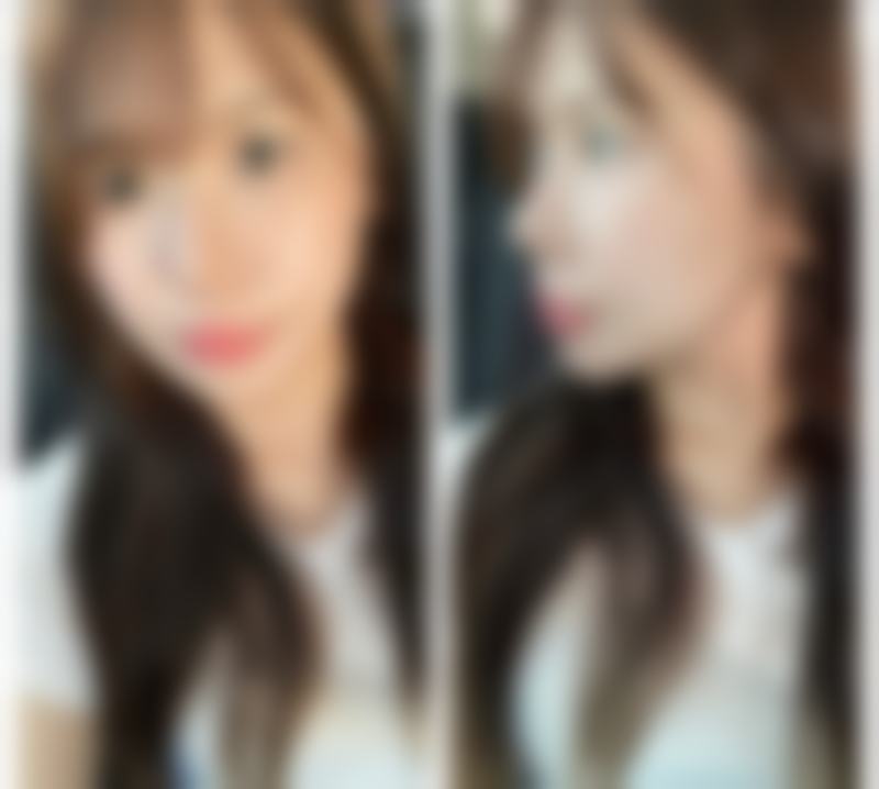 长沙你美医疗美容门诊部收费标准参考