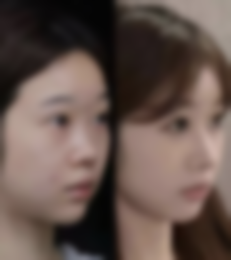 成都高新贞禾杭云整形医院收费标准参考