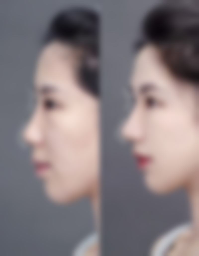 北京紫会所医疗美容诊所马艺桐医生技术好不好？