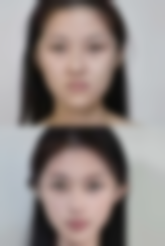 长沙中南大学湘雅医院谭鹭远医生口碑评价如何？