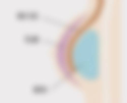 哪些因素会影响全身美白针成效的维持时间