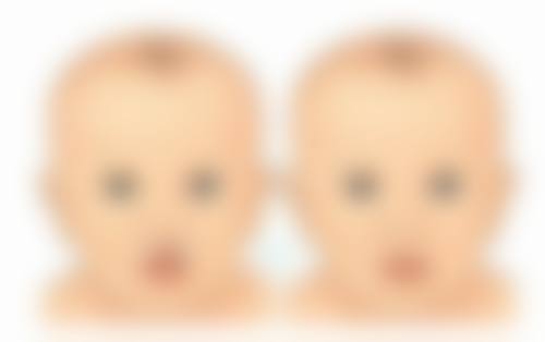 常见非手术去眼袋方法的副作用及规避