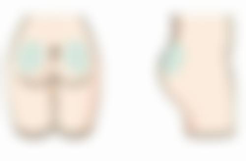 每年打瘦脸针会有抗体产生风险