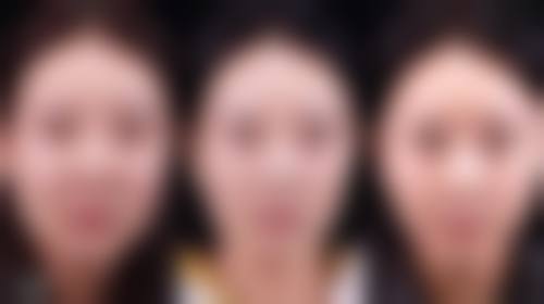 嘴凸的自行矫正方法