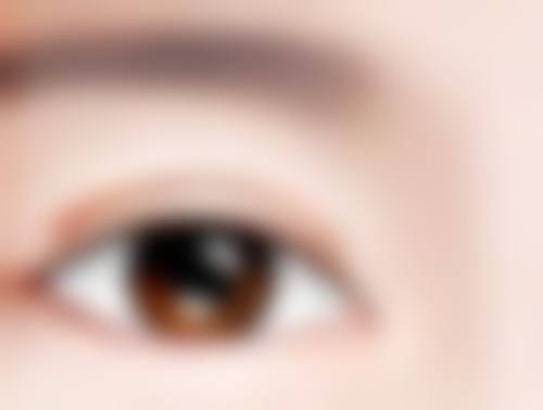 隆鼻的假体可以取出吗？何时取、怎么取及恢复情况一文为你揭秘