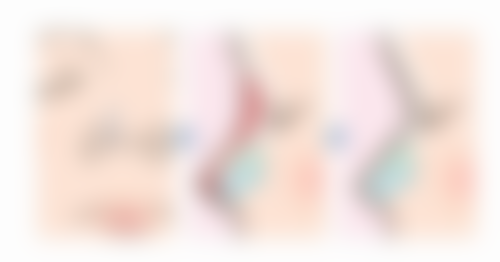 总结——邵阳东方医院整形美容中 心怎么样?