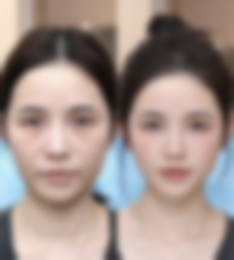 杭州诠昕医疗美容医生简介