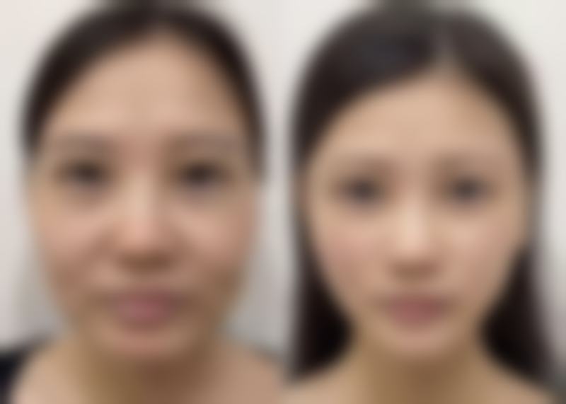 总结——武汉伊美馨医疗美容医院怎么样?