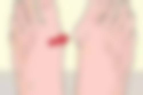 妈妈臀吸脂手术可能存在的危险