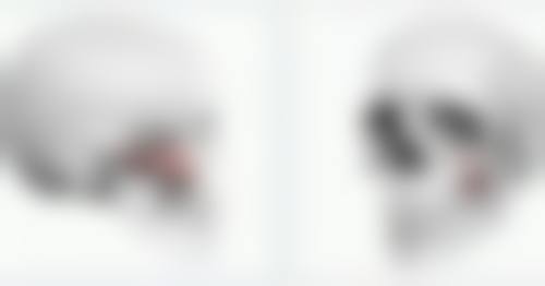 自体脂肪丰臀是永久的吗？效果维持受多因素影响，如何延长效果有办法 