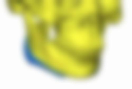 线提升提升丰太阳穴有效吗