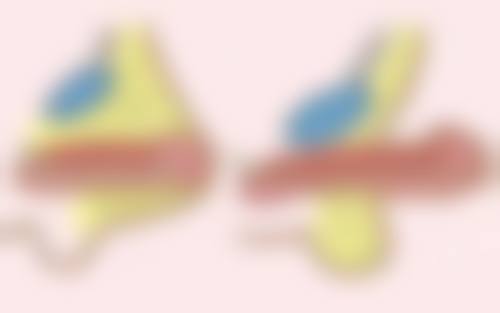 去眼袋对黑眼圈有什么影响