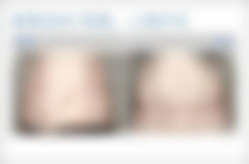 丰太阳穴有哪些注意事项