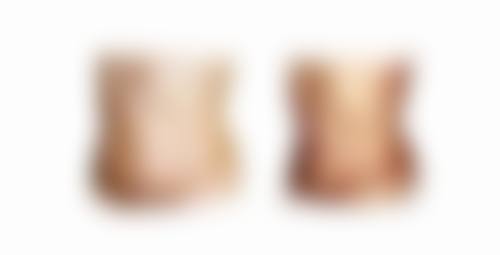 女性阴唇缩小是怎么回事 原因、手术方法、前后注意及维持时长全揭秘 