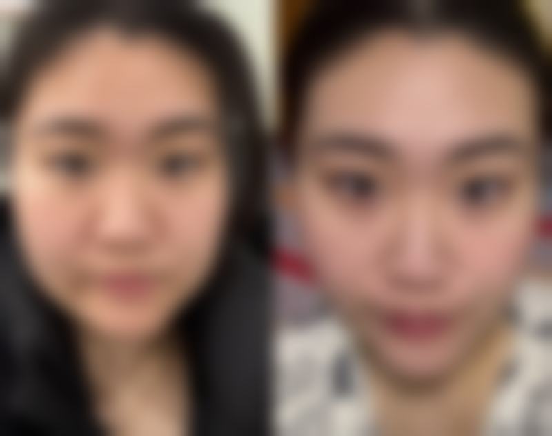 总结——温州小鹿丽格医疗美容诊所怎么样？