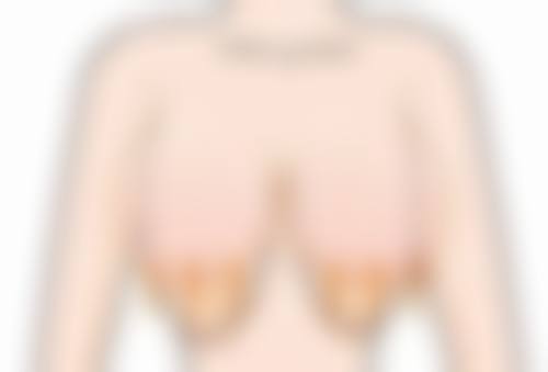 毛囊提取采用什么技术