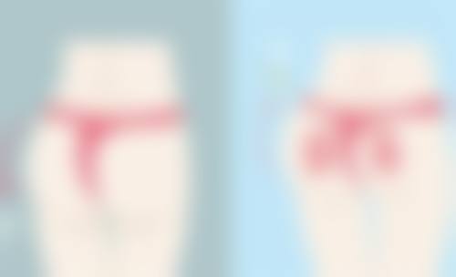 自体丰太阳穴术后修复与价格的综合考虑