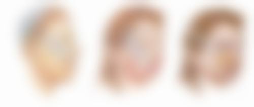 阴道紧缩手术有哪些好处？