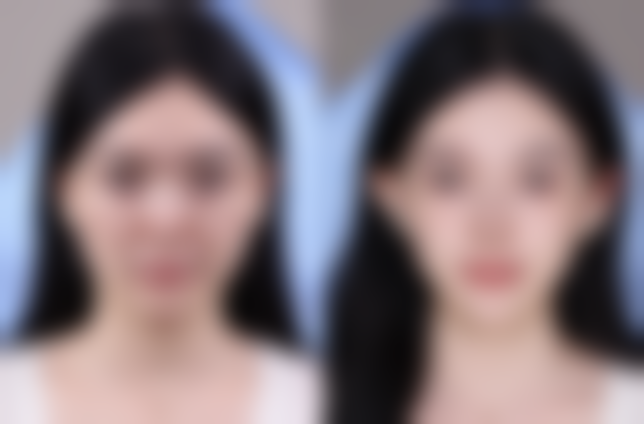 成都桦萱沁妍医疗美容诊所口碑如何？