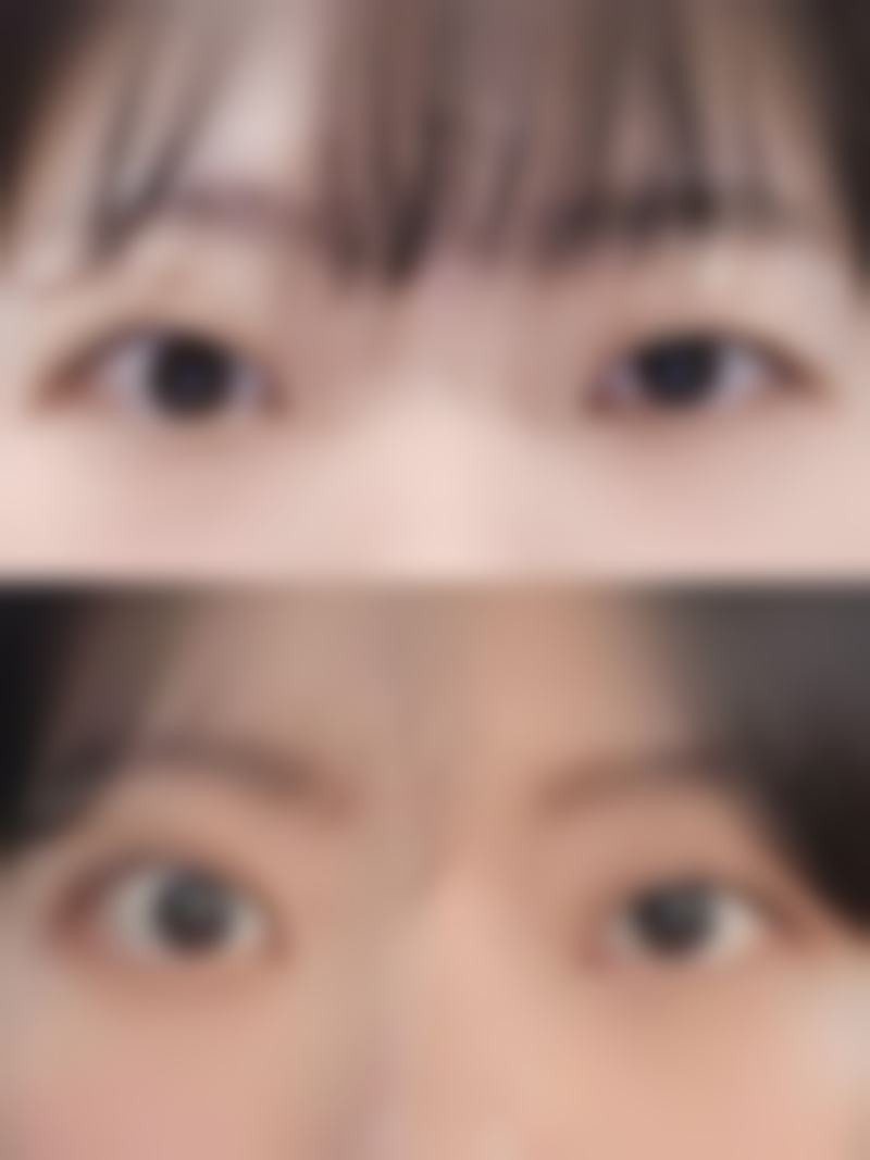 术后管理需要注意什么