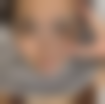 北京加减美超光子与刷酸体验咋样？申博医生妙手让痘印淡退皮肤光滑似剥壳蛋