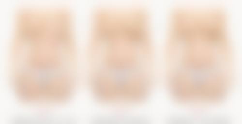 注射隆胸手术适合哪些人