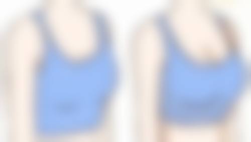 30岁隆鼻的成效维持