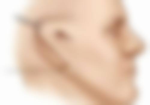 总结——南宁悦星贞韩医疗美容门诊部怎么样？