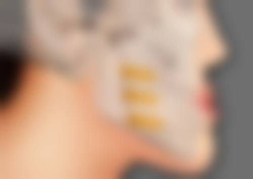 抽脂手术一定能让人变瘦吗