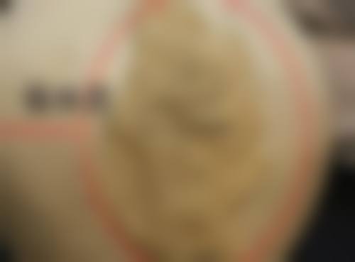 影响自体脂肪丰太阳穴危险程度的因素