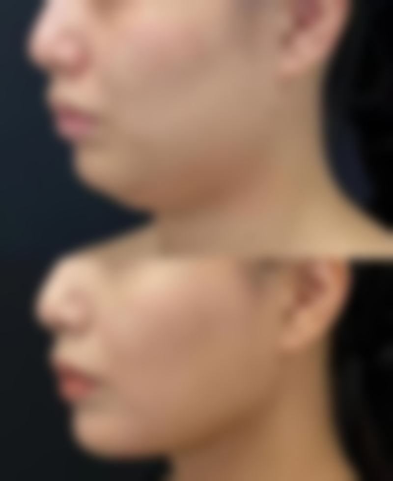 洛阳班爱荣医疗整形美容诊所李浩浩医生技术好不好？