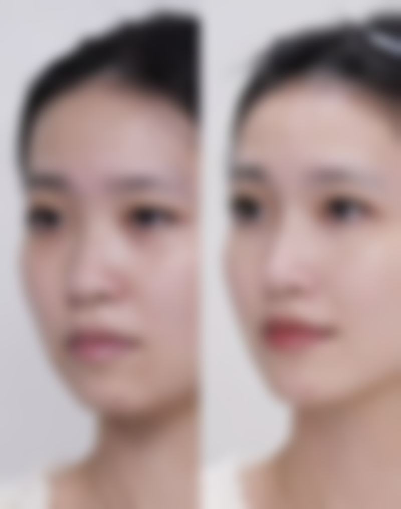沈阳韩秀宫医疗美容诊所医院技术好不好？