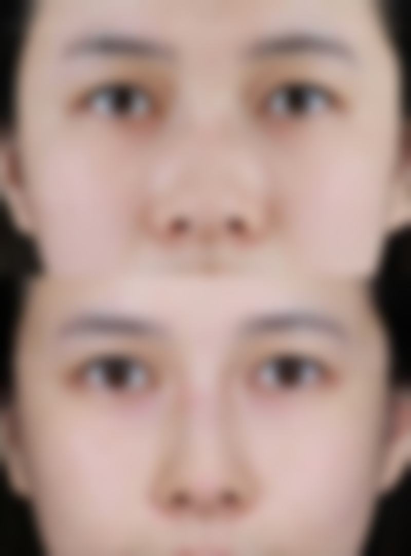 洛阳班爱荣医疗整形美容诊所李浩浩医生口碑评价如何？