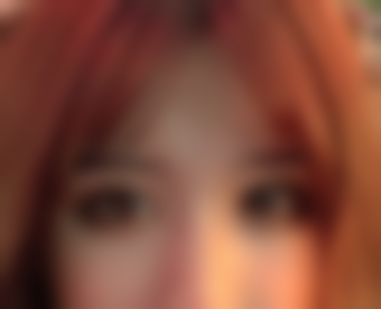 重庆松山医院医学美容科眼综合体验如何？何军医生助我告别大小眼气质提升！ 