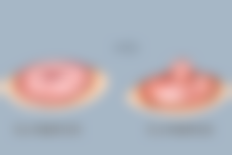 打美白针后的饮食注意事项