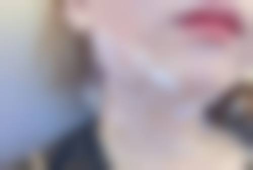 自体丰太阳穴成效的维持时间