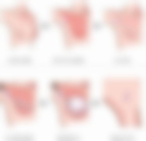 嘴唇整形手术的风险与收益如何权衡