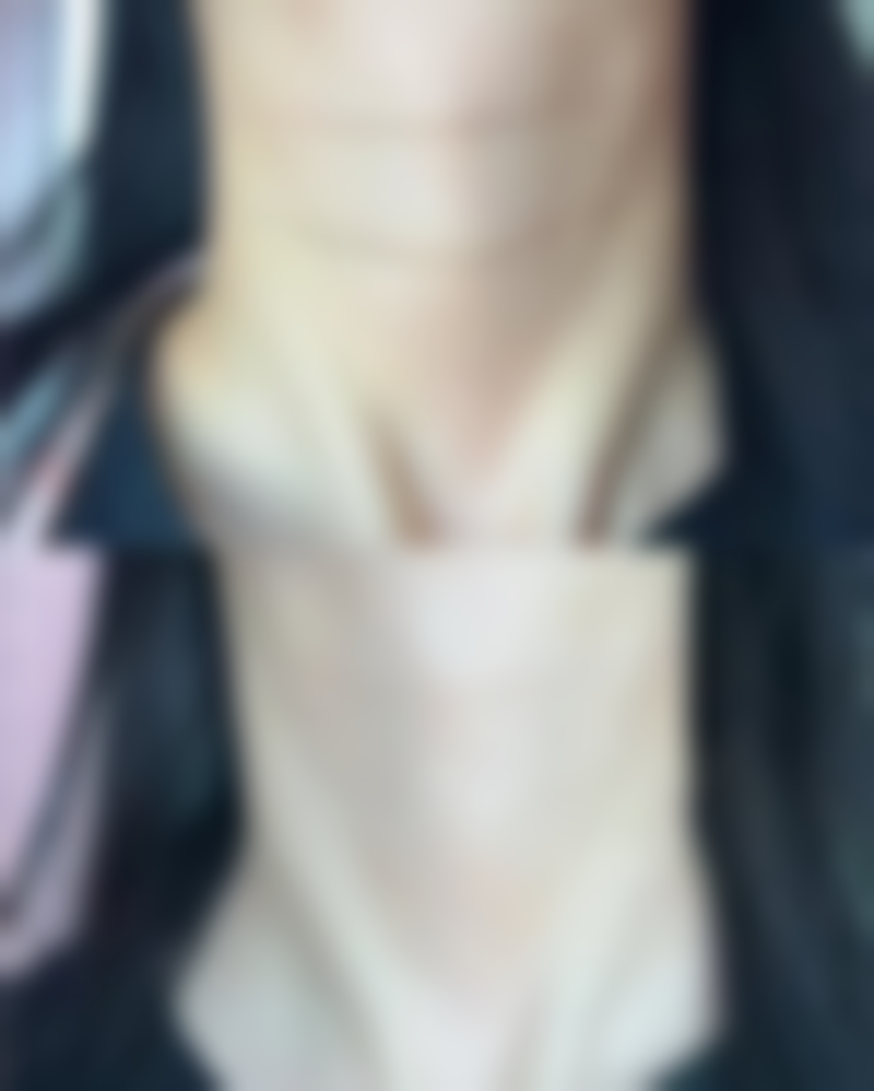 注射瘦脸针后还有其他需要注意的事项吗