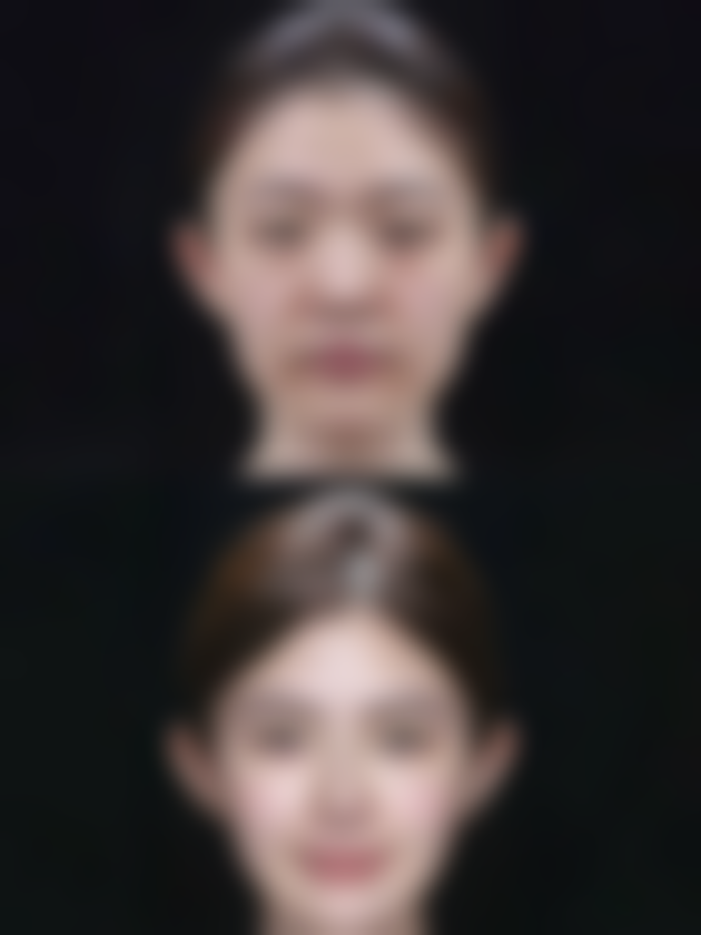 影响黄盖美白针注射频率的因素