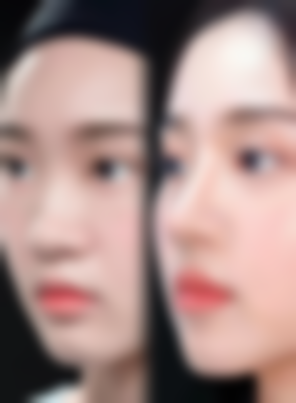 打黄盖美白针后的注意事项