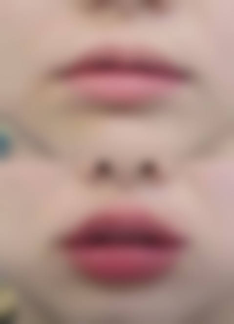 激光美白和打美白针哪个好？从适用人群、价格、风险多方面对比给你答案