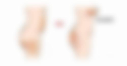 隆胸会造成哪些心理危害